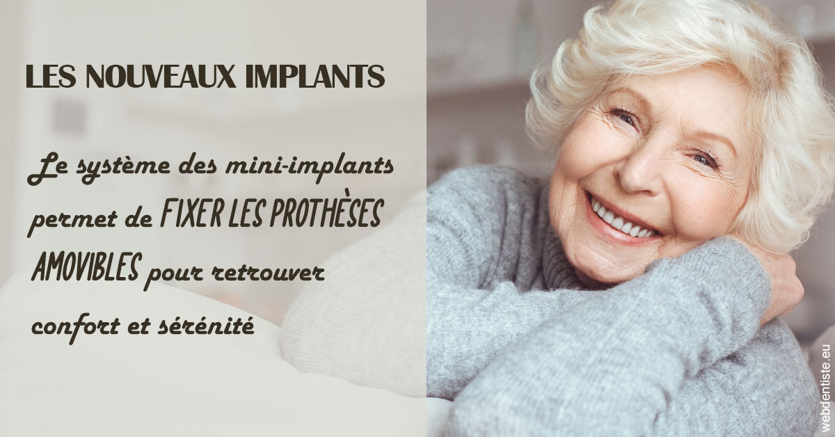 https://selarl-dr-yves-darmon.chirurgiens-dentistes.fr/Les nouveaux implants 1