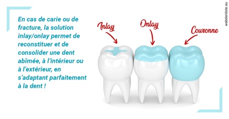 https://selarl-dr-yves-darmon.chirurgiens-dentistes.fr/L'INLAY ou l'ONLAY