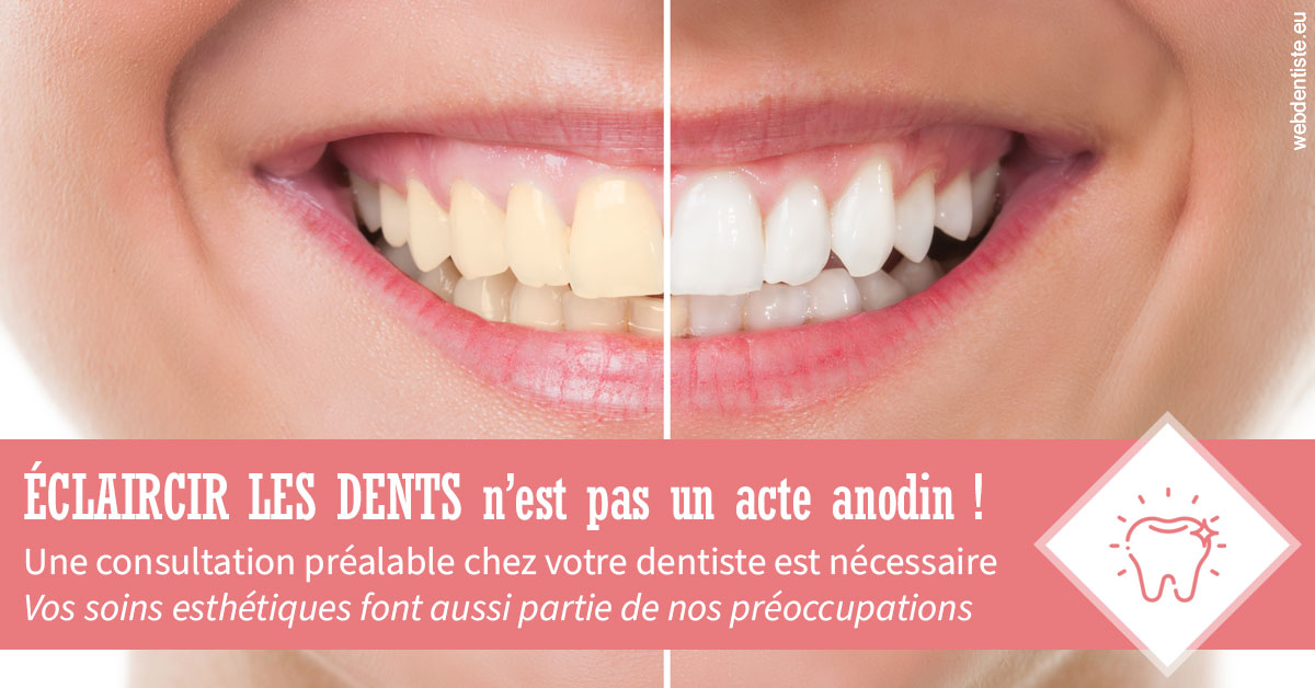 https://selarl-dr-yves-darmon.chirurgiens-dentistes.fr/Eclaircir les dents 1