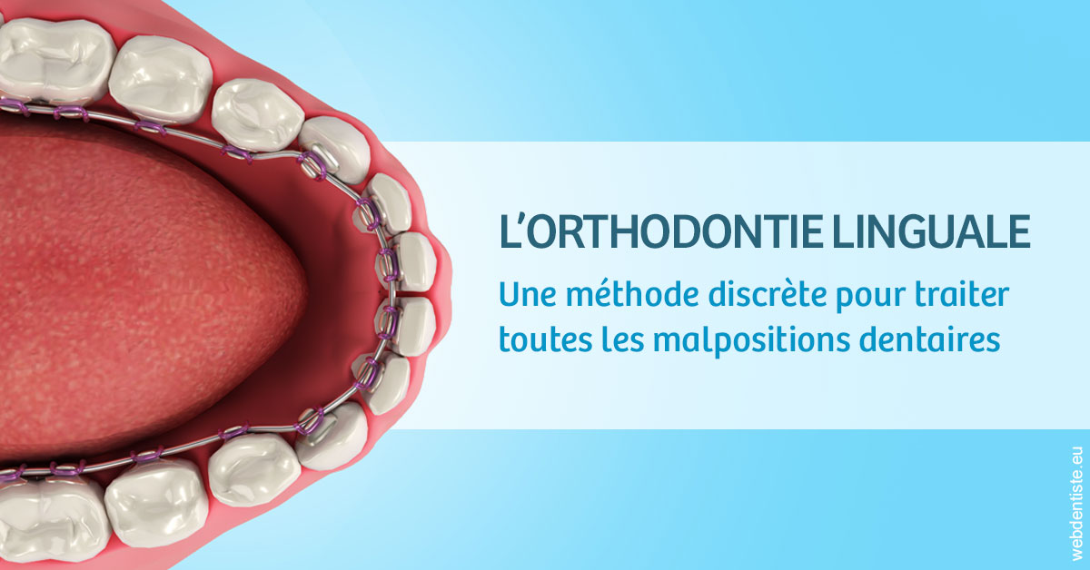 https://selarl-dr-yves-darmon.chirurgiens-dentistes.fr/L'orthodontie linguale 1