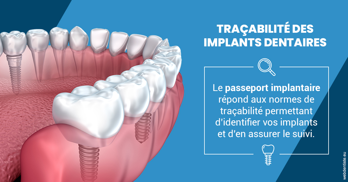 https://selarl-dr-yves-darmon.chirurgiens-dentistes.fr/T2 2023 - Traçabilité des implants 1