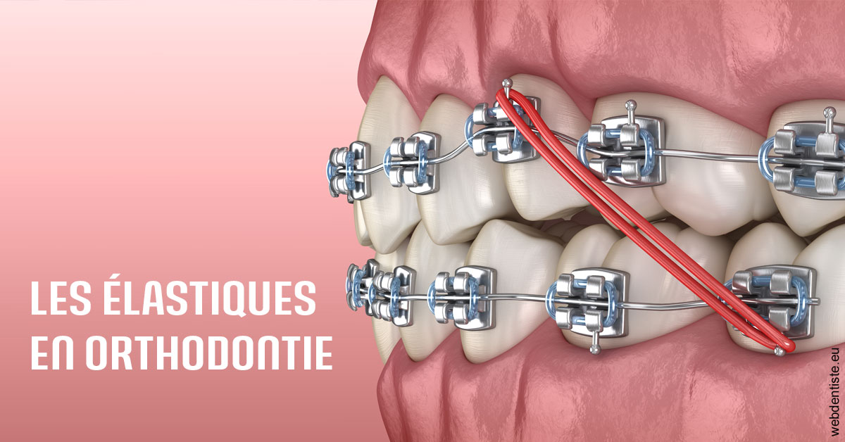 https://selarl-dr-yves-darmon.chirurgiens-dentistes.fr/Elastiques orthodontie 2