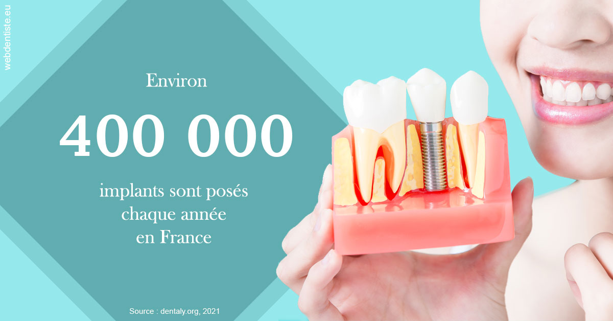 https://selarl-dr-yves-darmon.chirurgiens-dentistes.fr/Pose d'implants en France 2